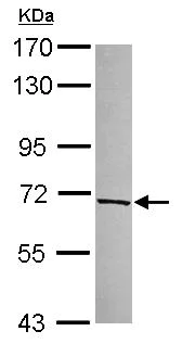 Western blot - Anti-KLHL21 antibody (AB111604)