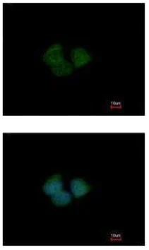 Immunocytochemistry/ Immunofluorescence - Anti-KLHL25 antibody - C-terminal (AB229246)
