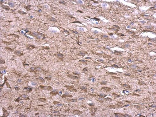 Immunohistochemistry (Formalin/PFA-fixed paraffin-embedded sections) - Anti-KLHL25 antibody - C-terminal (AB229246)