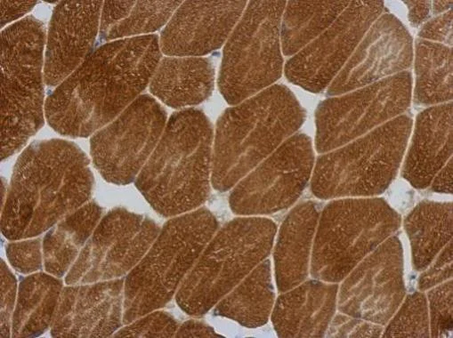 Immunohistochemistry (Formalin/PFA-fixed paraffin-embedded sections) - Anti-KLHL25 antibody - C-terminal (AB229246)