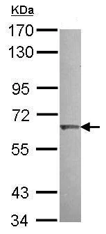 Western blot - Anti-KLHL25 antibody - C-terminal (AB229246)