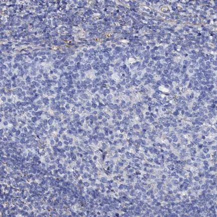 Immunohistochemistry (Formalin/PFA-fixed paraffin-embedded sections) - Anti-KLHL32 antibody (AB243805)