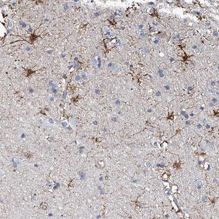 Immunohistochemistry (Formalin/PFA-fixed paraffin-embedded sections) - Anti-KLHL32 antibody (AB243805)