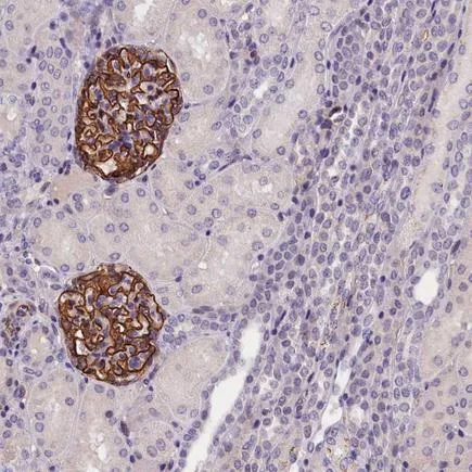 Immunohistochemistry (Formalin/PFA-fixed paraffin-embedded sections) - Anti-KLHL35 antibody (AB243490)