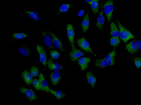Immunocytochemistry/ Immunofluorescence - Anti-KLHL6 antibody [EPR13484] (AB182163), expandable thumbnail