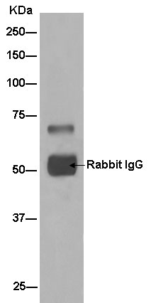 Immunoprecipitation - Anti-KLHL6 antibody [EPR13484] (AB182163), expandable thumbnail