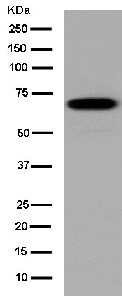 Western blot - Anti-KLHL6 antibody [EPR13484] (AB182163), expandable thumbnail
