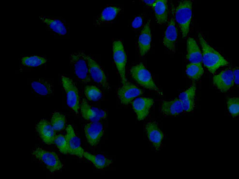 Immunocytochemistry/ Immunofluorescence - Anti-KLHL6 antibody [EPR13484] - BSA and Azide free (AB250605)