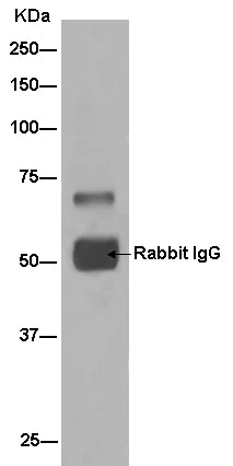 Immunoprecipitation - Anti-KLHL6 antibody [EPR13484] - BSA and Azide free (AB250605)