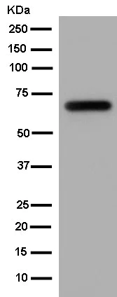Western blot - Anti-KLHL6 antibody [EPR13484] - BSA and Azide free (AB250605)