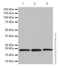 Western blot - Anti-KLLN antibody [EPR16934] (AB197892), expandable thumbnail