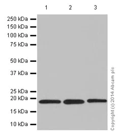 Western blot - Anti-KLLN antibody [EPR16934] (AB197892)