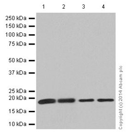 Western blot - Anti-KLLN antibody [EPR16934] (AB197892), expandable thumbnail