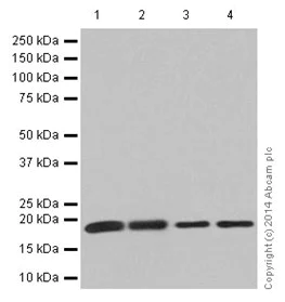 Western blot - Anti-KLLN antibody [EPR16934] (AB197892)