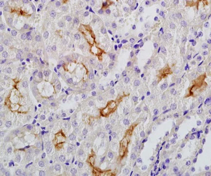 Immunohistochemistry (Formalin/PFA-fixed paraffin-embedded sections) - Anti-Klotho antibody (AB203576)