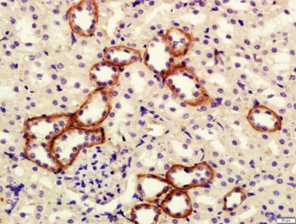 Immunohistochemistry (Formalin/PFA-fixed paraffin-embedded sections) - Anti-Klotho antibody (AB203576)