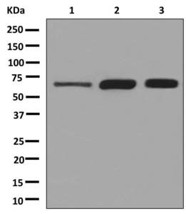 Western blot - Anti-Klotho antibody [EPR6856] (AB181373)