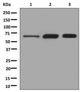 Western blot - Anti-Klotho antibody [EPR6856] (AB181373)