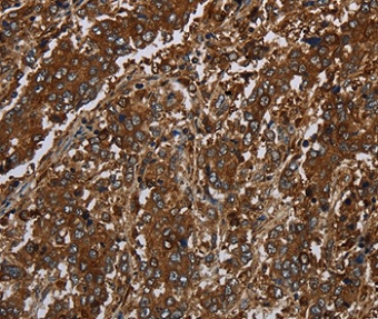 Immunohistochemistry (Formalin/PFA-fixed paraffin-embedded sections) - Anti-KLRF1 antibody (AB198928)