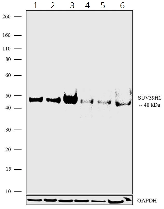 Western blot - Anti-KMT1A / SUV39H1 antibody [3HCLC] (AB277804)