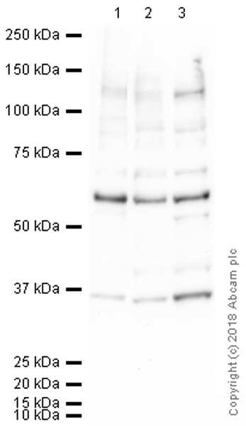 Western blot - Anti-KMT1A / SUV39H1 antibody [44.1] (AB12405)