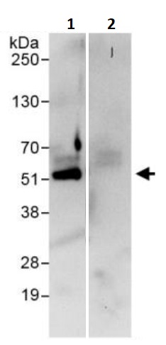 Immunoprecipitation - Anti-KMT1A / SUV39H1 antibody (AB245380), expandable thumbnail