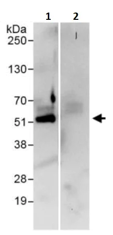 Immunoprecipitation - Anti-KMT1A / SUV39H1 antibody (AB245380)