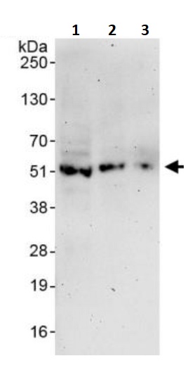 Western blot - Anti-KMT1A / SUV39H1 antibody (AB245380), expandable thumbnail