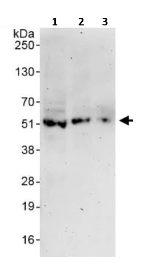 Western blot - Anti-KMT1A / SUV39H1 antibody (AB245380)