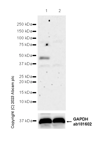 Western blot - Anti-KMT1A / SUV39H1 antibody [EPR24200-179] - BSA and Azide free (AB309472)