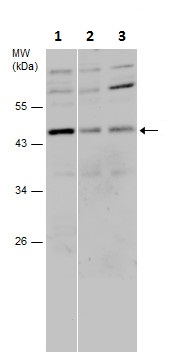 Western blot - Anti-KMT1B / SUV39H2 antibody (AB229493)