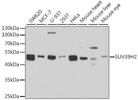 Western blot - Anti-KMT1B / SUV39H2 antibody - C-terminal (AB189842)