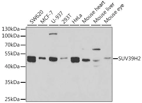 Western blot - Anti-KMT1B / SUV39H2 antibody - C-terminal (AB189842)