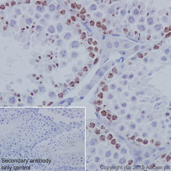 Immunohistochemistry (Formalin/PFA-fixed paraffin-embedded sections) - Anti-KMT1B / SUV39H2 antibody [EPR18495] - BSA and Azide free (AB240313)