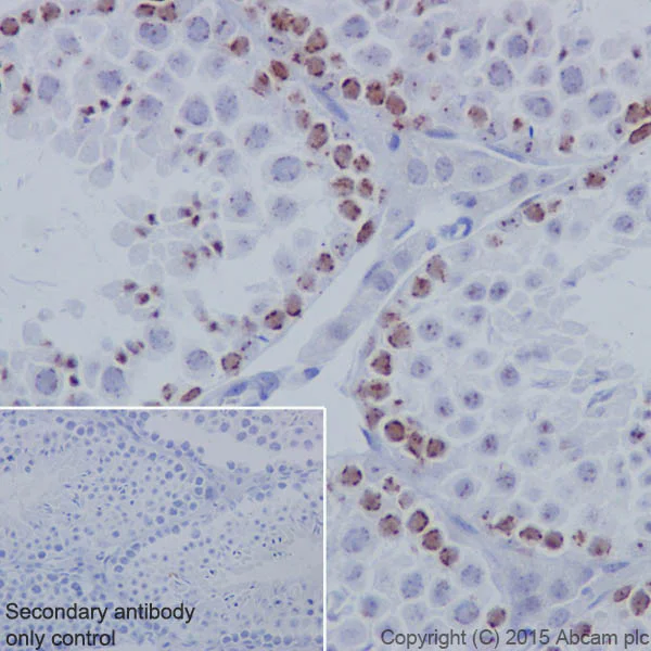 Immunohistochemistry (Formalin/PFA-fixed paraffin-embedded sections) - Anti-KMT1B / SUV39H2 antibody [EPR18495] - BSA and Azide free (AB240313)