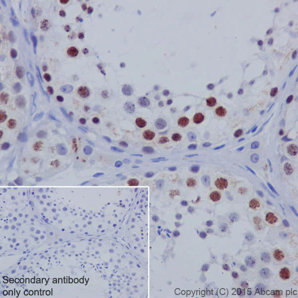 Immunohistochemistry (Formalin/PFA-fixed paraffin-embedded sections) - Anti-KMT1B / SUV39H2 antibody [EPR18495] - BSA and Azide free (AB240313)