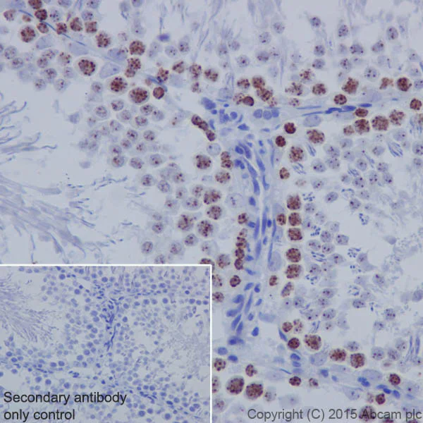 Immunohistochemistry (Formalin/PFA-fixed paraffin-embedded sections) - Anti-KMT1B / SUV39H2 antibody [EPR18495] - BSA and Azide free (AB240313)