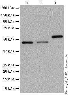 Western blot - Anti-KMT1B / SUV39H2 antibody [EPR18495] - BSA and Azide free (AB240313)