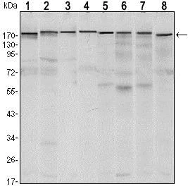Western blot - Anti-KMT1E / SETDB1 antibody [5H6A12] (AB107225)