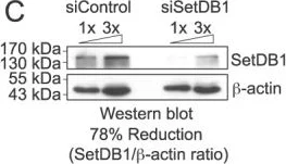 Western blot - Anti-KMT1E / SETDB1 antibody (AB12317)