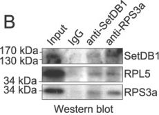 Western blot - Anti-KMT1E / SETDB1 antibody (AB12317)