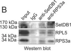 Western blot - Anti-KMT1E / SETDB1 antibody (AB12317)