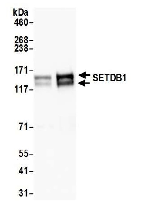 Western blot - Anti-KMT1E / SETDB1 antibody (AB12317), expandable thumbnail