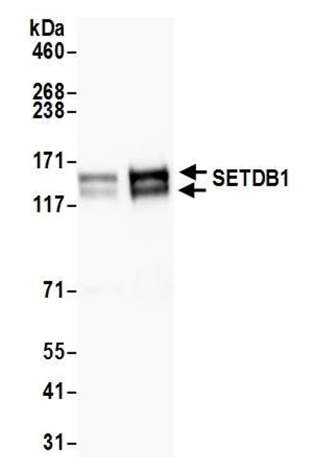 Western blot - Anti-KMT1E / SETDB1 antibody (AB12317)