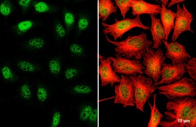 Immunocytochemistry/ Immunofluorescence - Anti-KMT1E / SETDB1 antibody (AB228575)