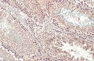 Immunohistochemistry (Formalin/PFA-fixed paraffin-embedded sections) - Anti-KMT1E / SETDB1 antibody (AB228575)