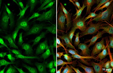 Immunocytochemistry/ Immunofluorescence - Anti-KMT1E / SETDB1 antibody [HL1645] - BSA and Azide free (AB313862)