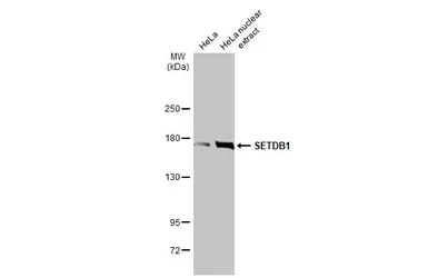 Western blot - Anti-KMT1E / SETDB1 antibody [HL1645] - BSA and Azide free (AB313862), expandable thumbnail