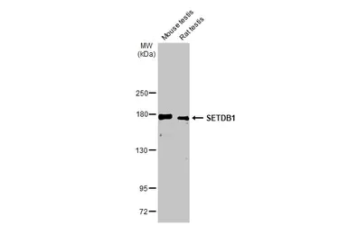 Western blot - Anti-KMT1E / SETDB1 antibody [HL1645] - BSA and Azide free (AB313862)