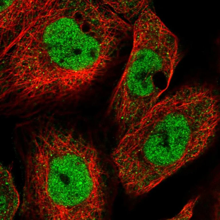 Immunocytochemistry/ Immunofluorescence - Anti-KMT2A Antibody (AB327228)